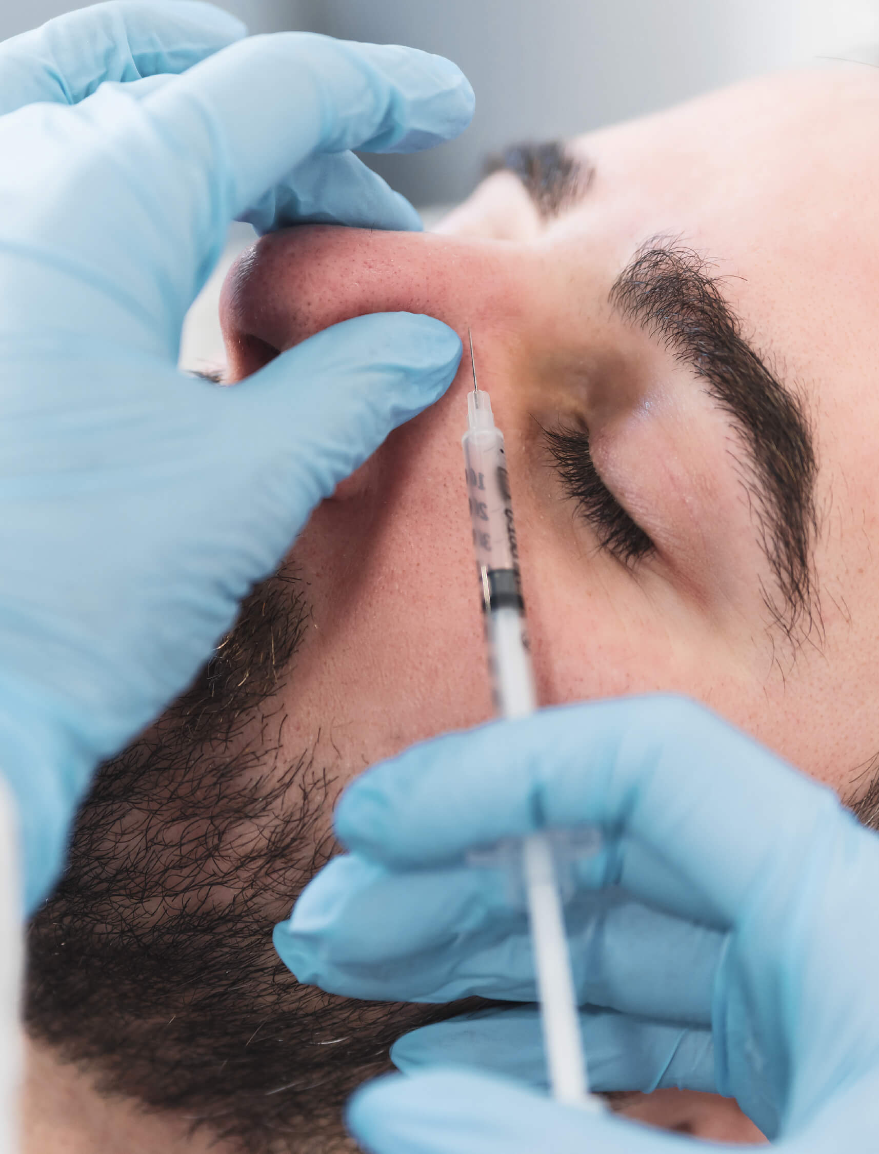 Avantages des injections de Brotox: raffermit et tonifie la peau