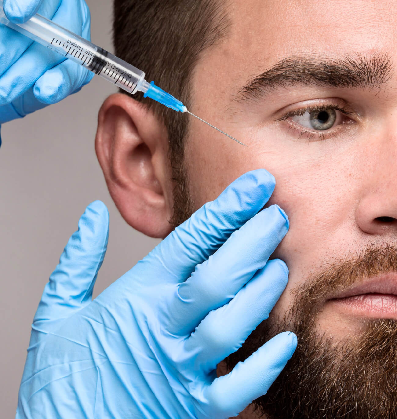 Avantages des injections de Brotox: résultat naturels