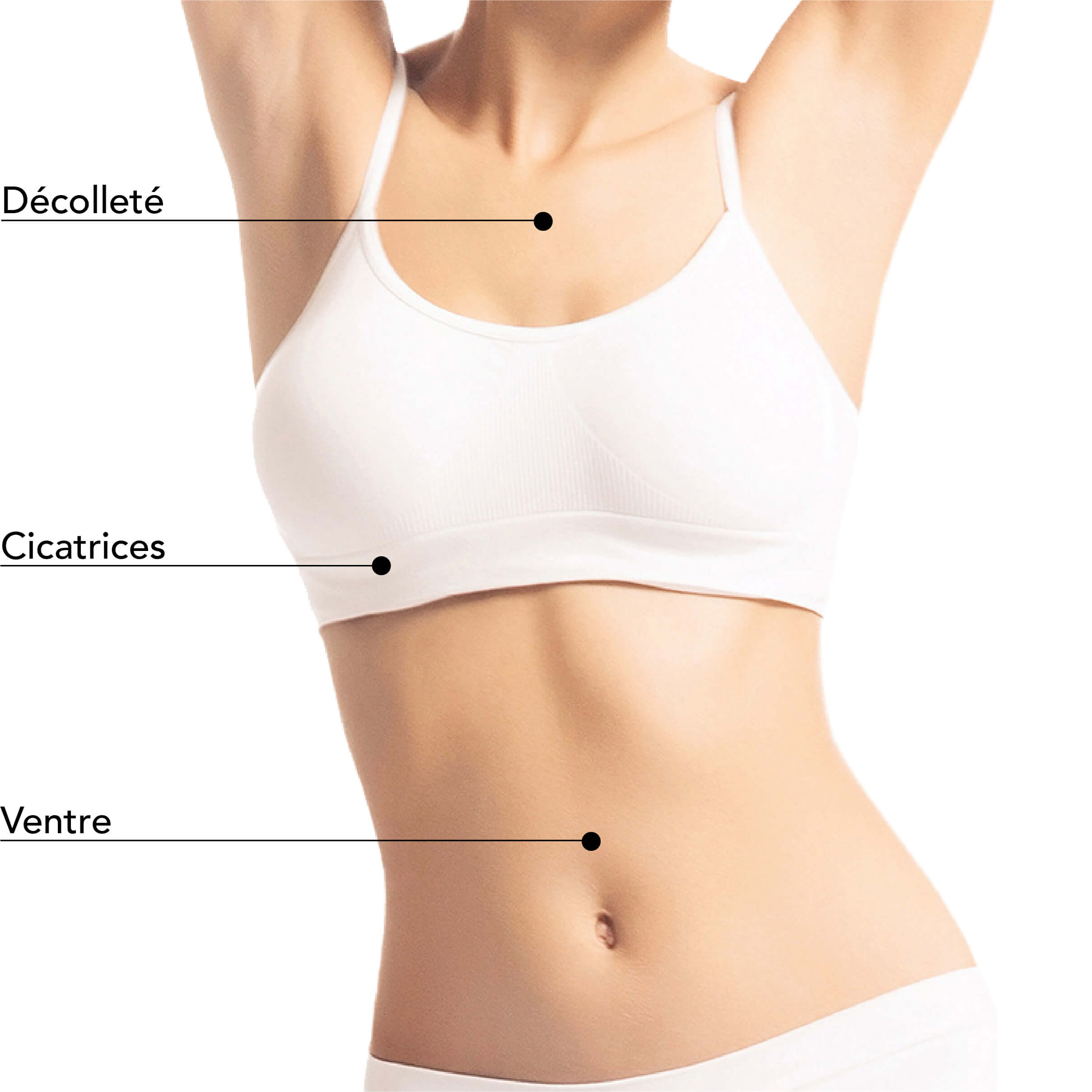https://www.stlaurentme.com/wp-content/uploads/2024/05/St-Laurent-Medico-Esthetique_Microneedling-RF-Radio-Frequence_Zones_traitable_2.jpg