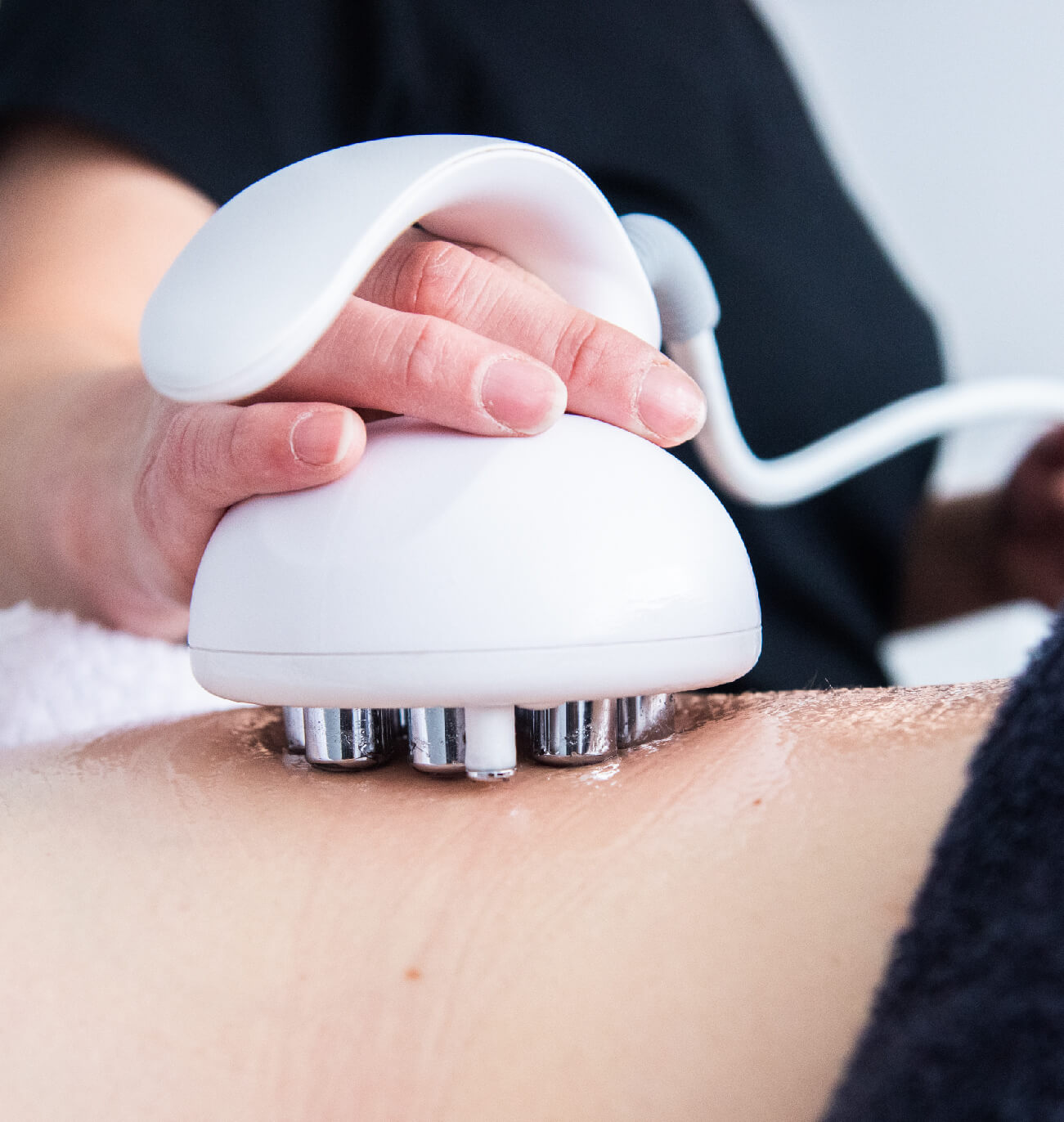 Gros plan sur le traitement Venus Freeze : application de la radiofréquence multipolaire et des champs magnétiques sur l’abdomen pour raffermir la peau, réduire la cellulite et stimuler la production de collagène. Soin esthétique innovant offert par St-Laurent Médico-Esthétique