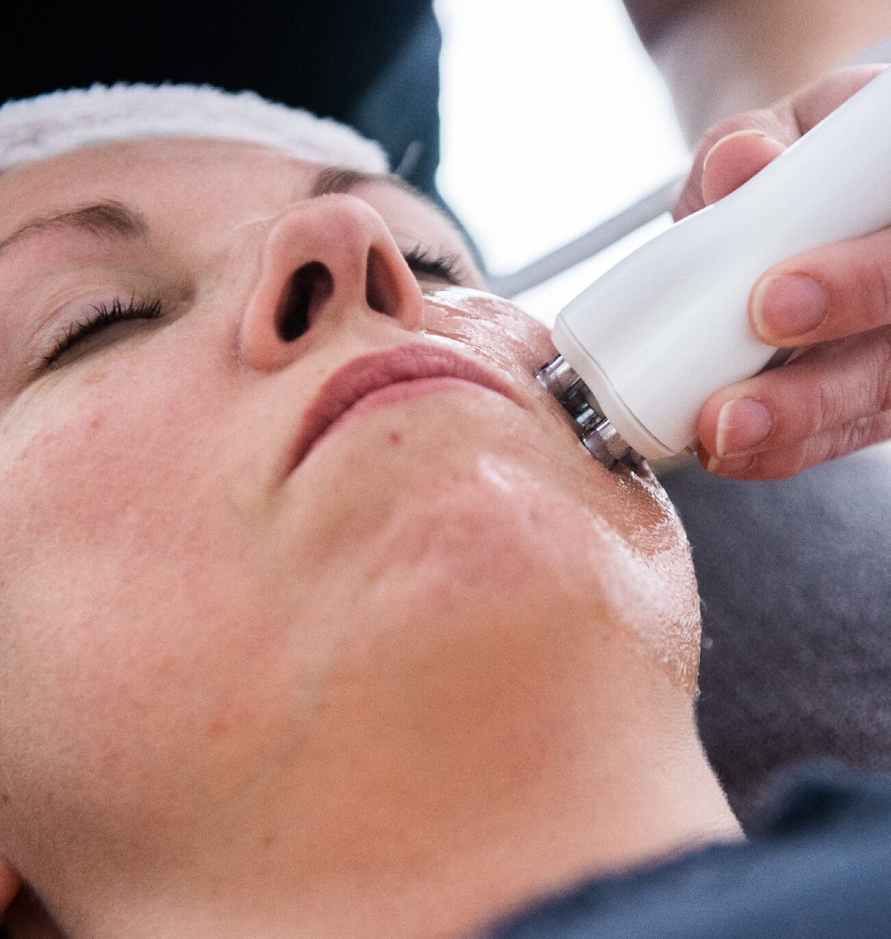 Gros plan sur le traitement Venus Freeze : application de la radiofréquence multipolaire et des champs magnétiques sur le visage pour raffermir la peau, réduire la cellulite et stimuler la production de collagène. Soin esthétique innovant offert par St-Laurent Médico-Esthétique