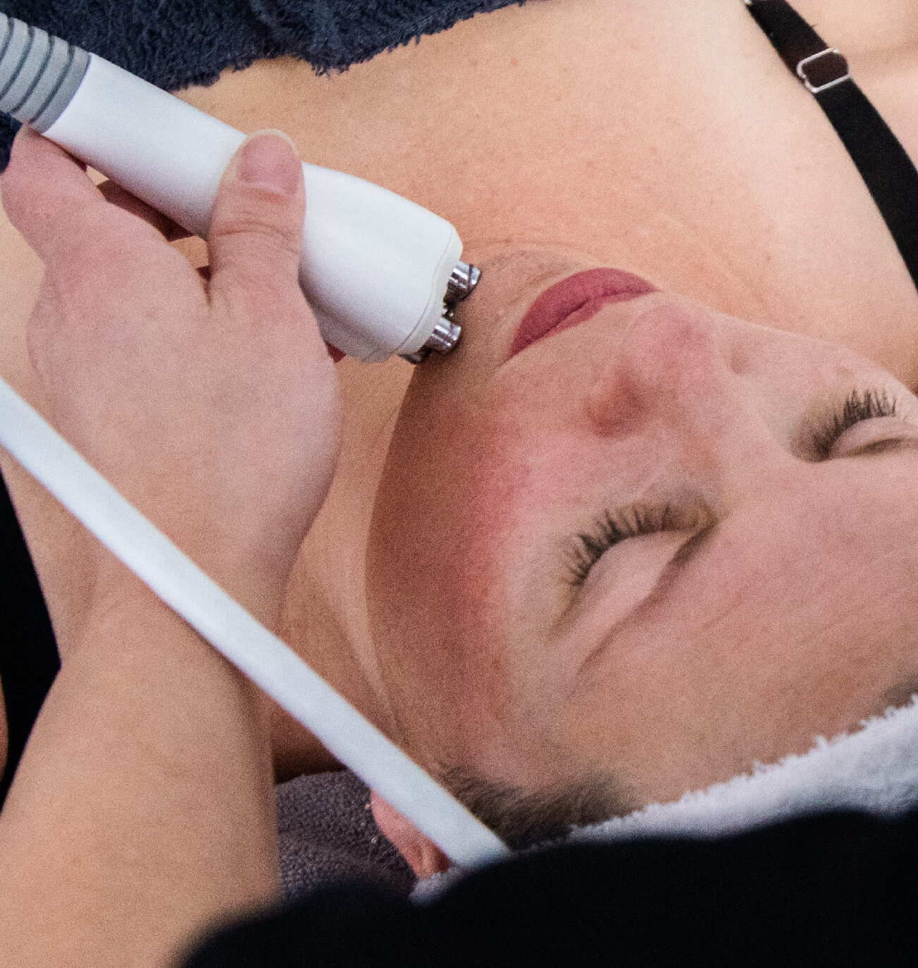 Gros plan sur le traitement Venus Freeze : application de la radiofréquence multipolaire et des champs magnétiques sur le visage pour raffermir la peau, réduire la cellulite et stimuler la production de collagène. Soin esthétique innovant offert par St-Laurent Médico-Esthétique