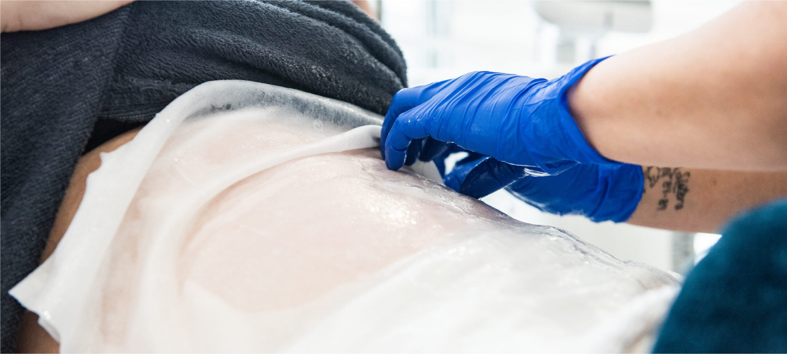ME+Cryo360 : Avant, Pendant et Après !