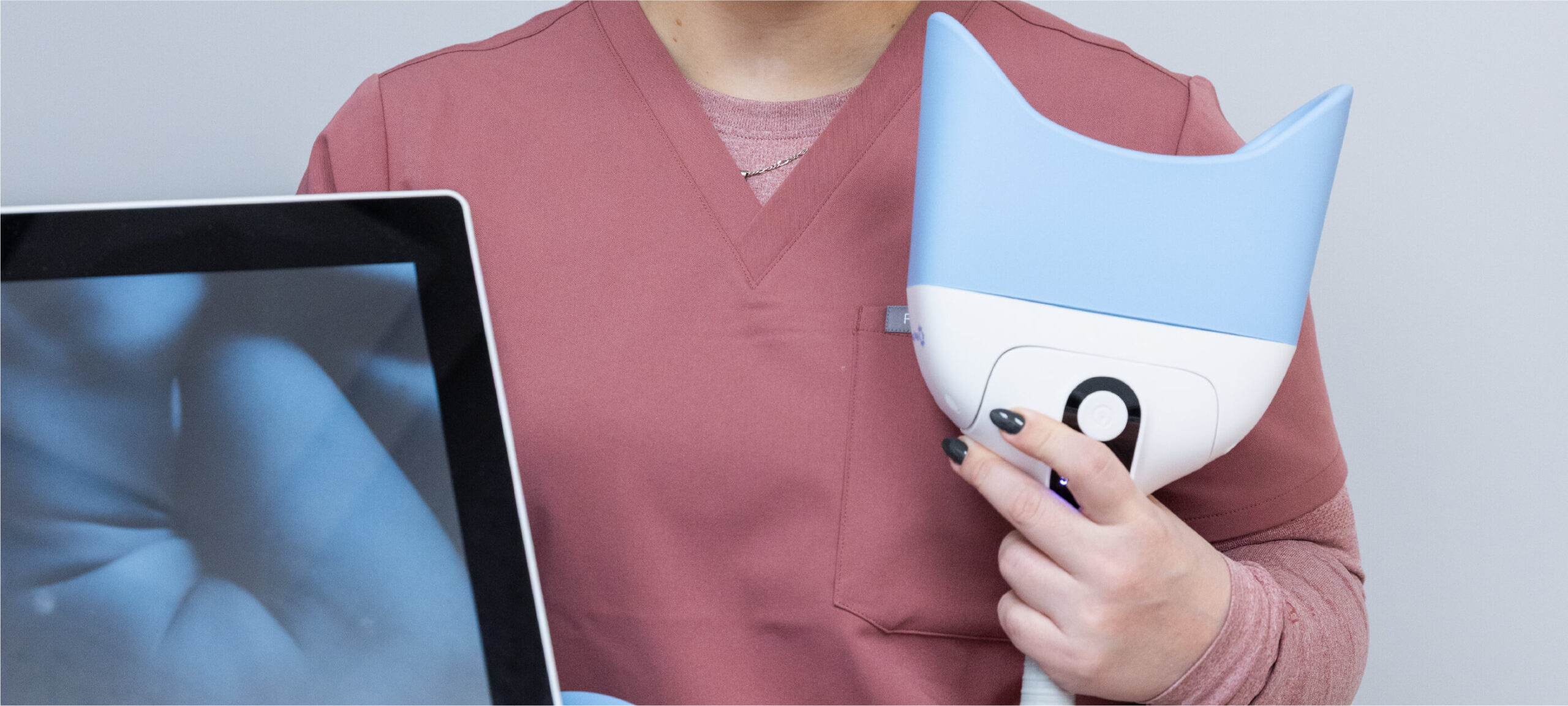 Traitement de Cryolipolyse ME+Cryo360 : Une révolution