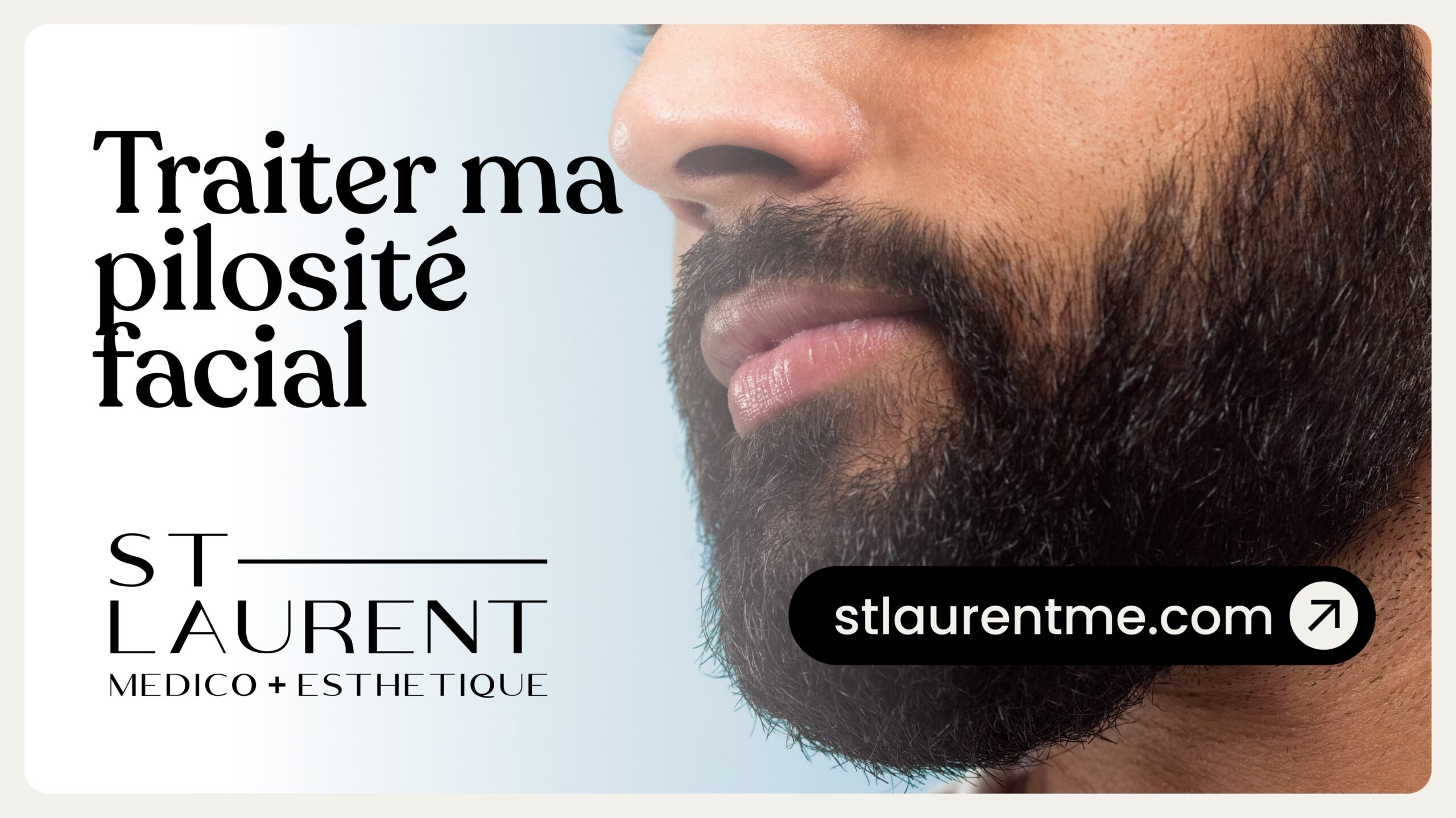Traiter ma pilosité facial | St-Laurent Médico-Esthétique