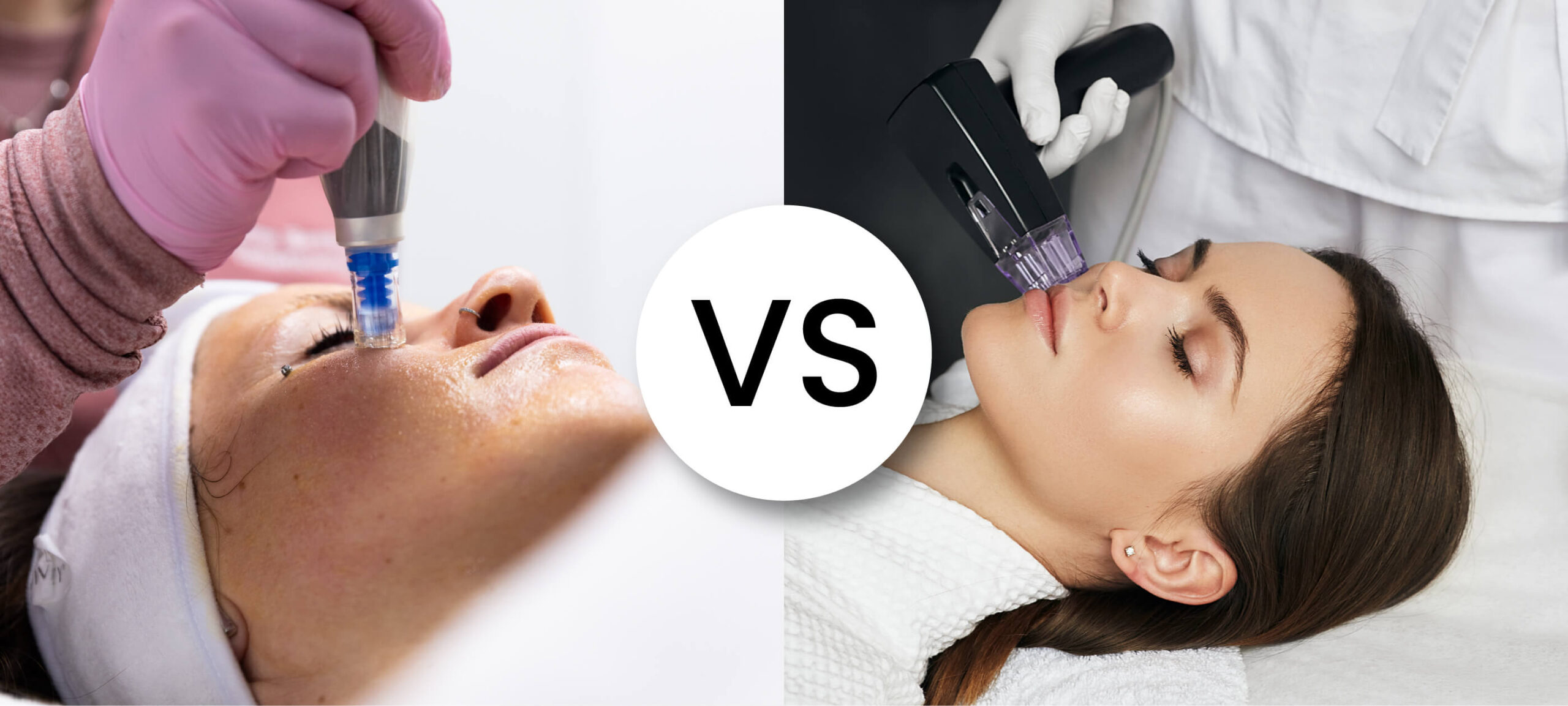 Microneedling seul ou avec radiofréquence : lequel choisir selon votre peau?