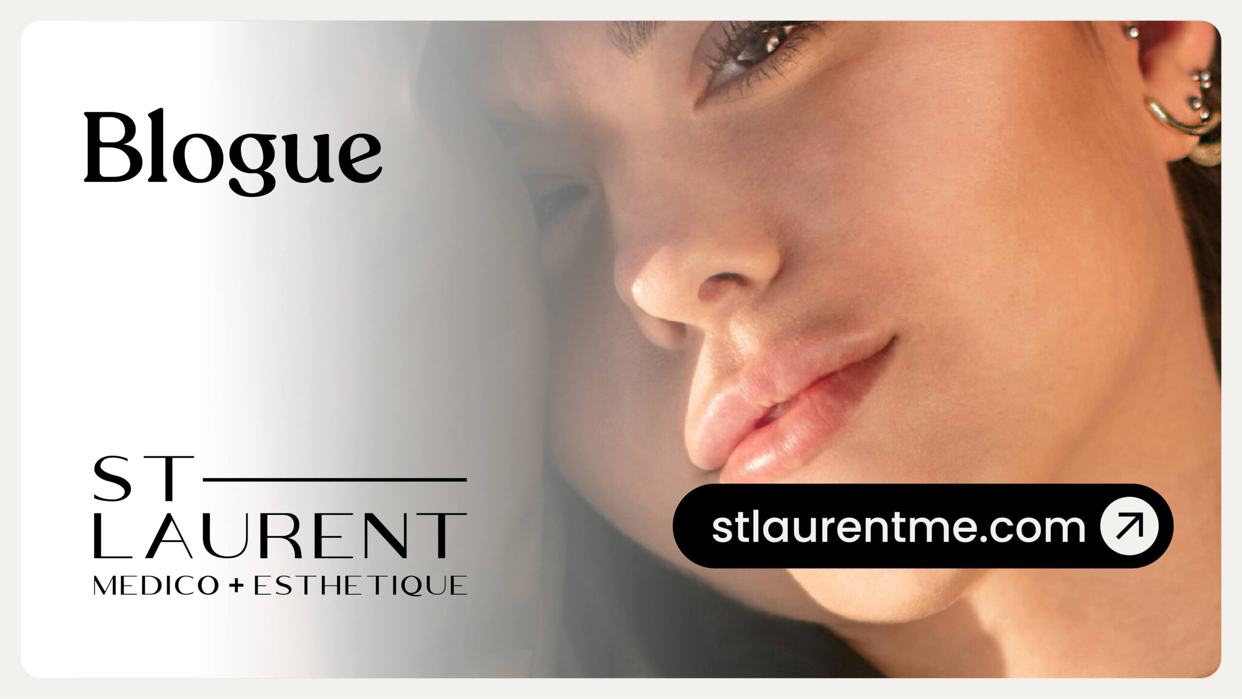 Explorez notre blogue pour des conseils, tendances et découvertes en médico-esthétique. À lire sur stlaurentme.com