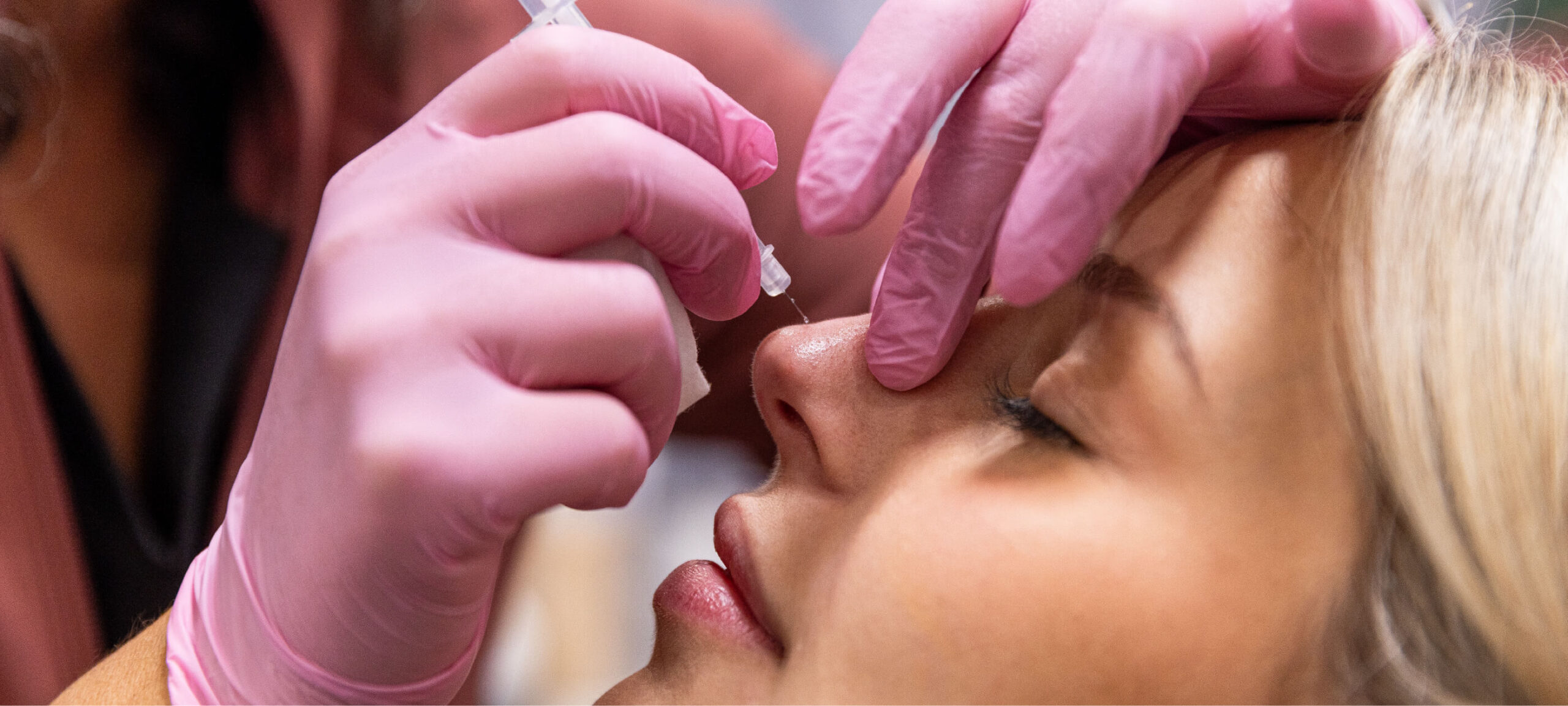 La rhinoplastie non chirurgicale : tout ce que vous devez savoir