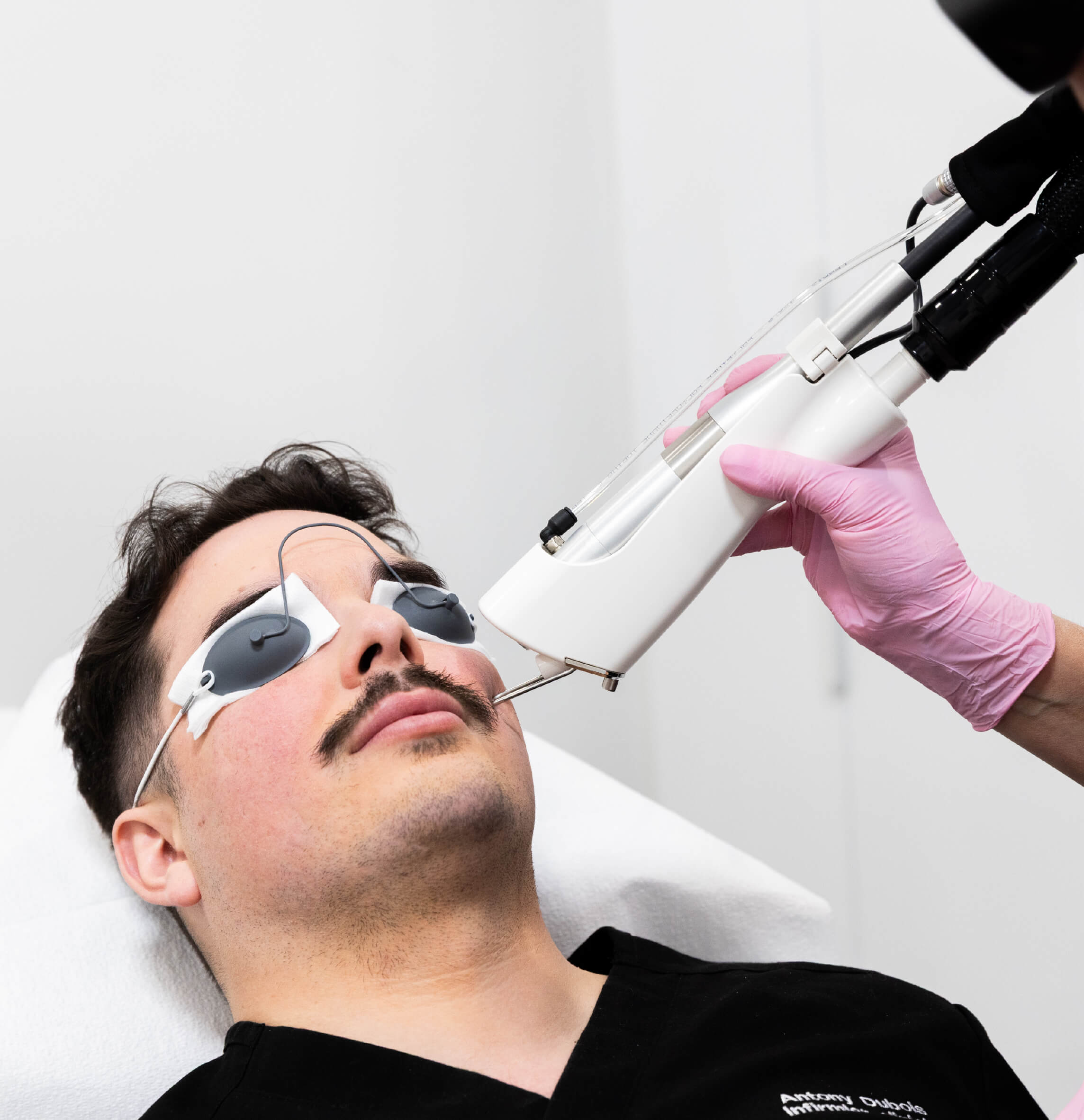 Traitement Boost Collagène au laser Quanta appliqué sur le visage d’un homme portant des lunettes de protection, pour améliorer la fermeté et la qualité de la peau.