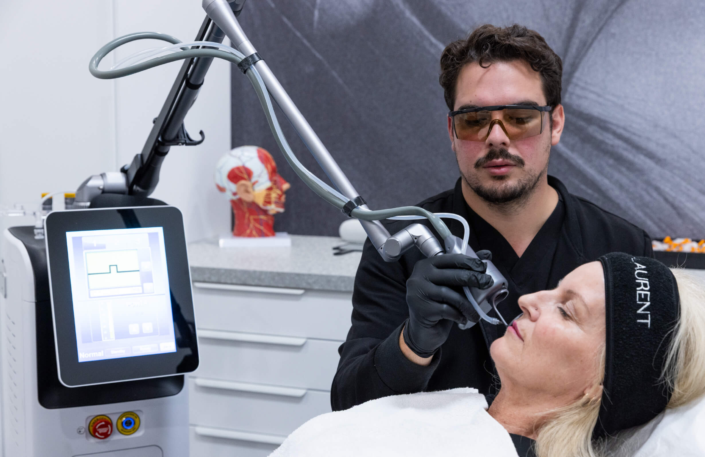 Traitement du visage au laser CO2 réalisé sur une femme pour améliorer la texture de la peau, les rides et les taches pigmentaires.