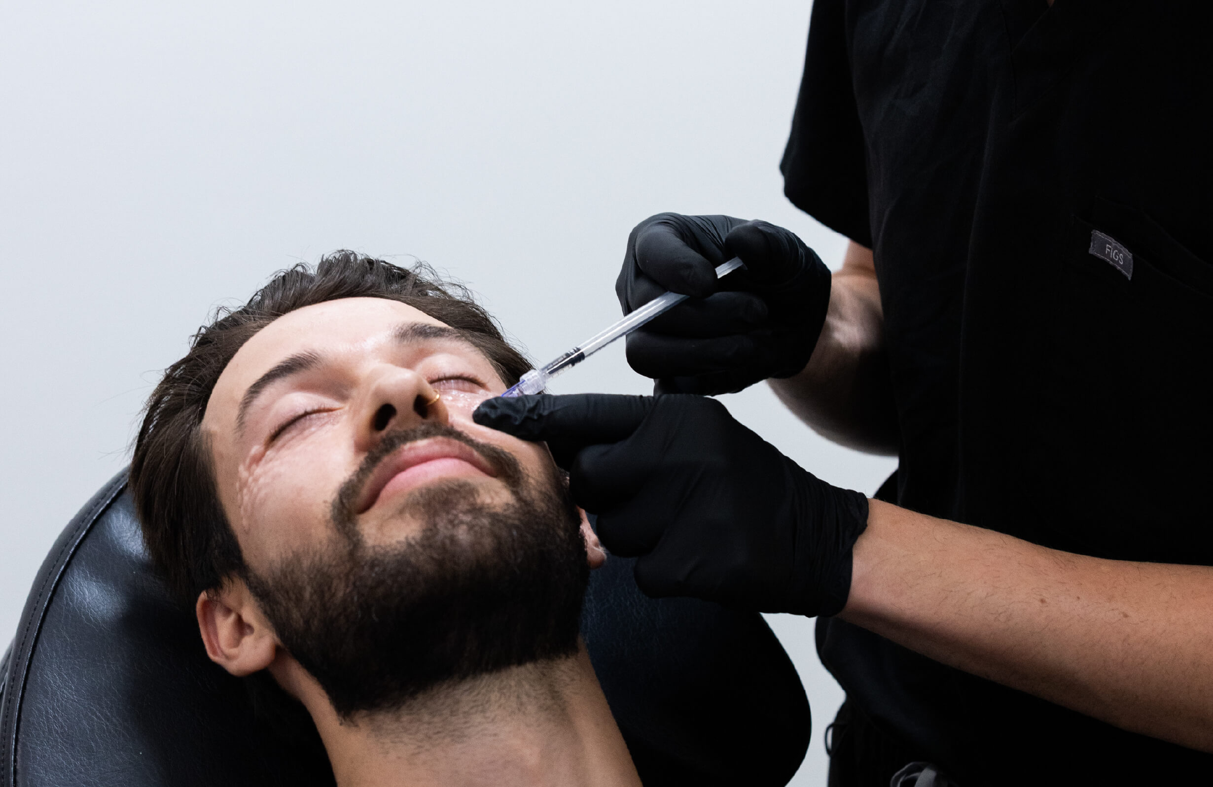 Injection CernesBoosters sous les yeux d’un homme pour traiter les cernes et améliorer l’apparence du regard.
