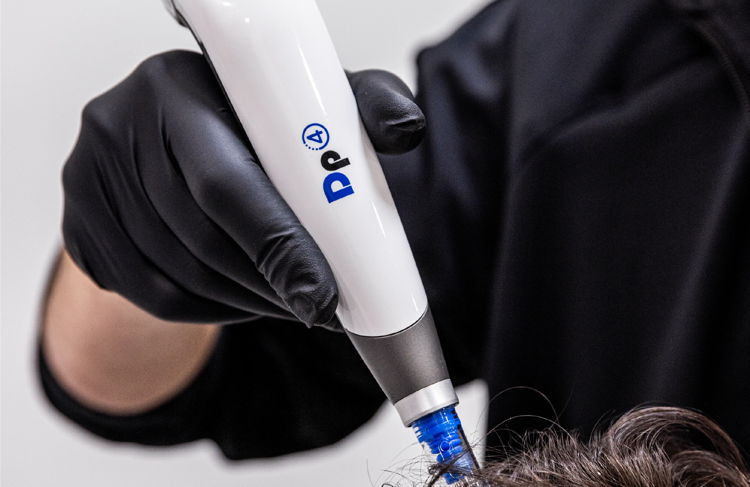 Traitement capillaire aux exosomes avec le dispositif de microneedling Dermapen 4 pour stimuler la repousse des cheveux.