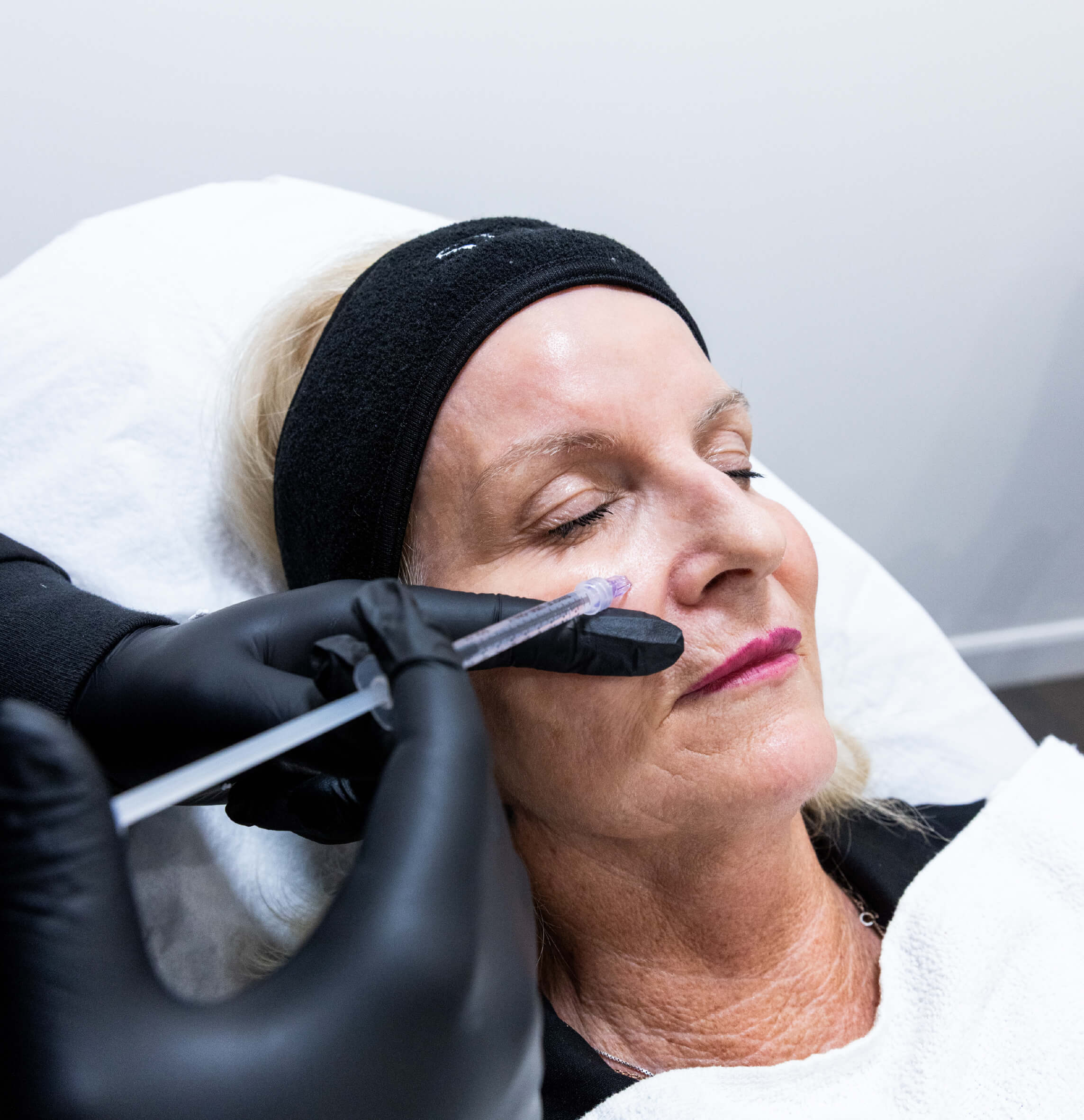 Injection de microtox dans la joue d’une femme pour lisser les ridules et raffermir la peau.