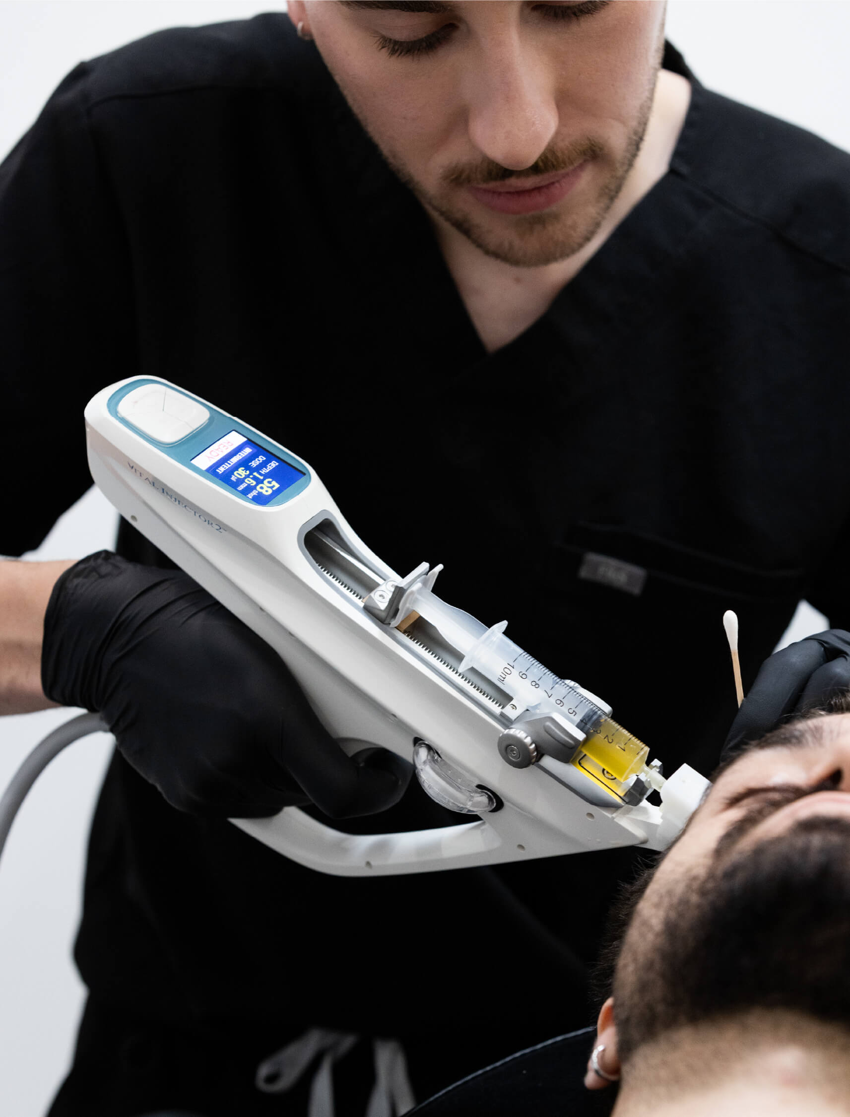 Injection de PRP (plasma riche en plaquettes) dans le cuir chevelu à l’aide d’un injecteur automatique pour favoriser la repousse capillaire chez un patient masculin.