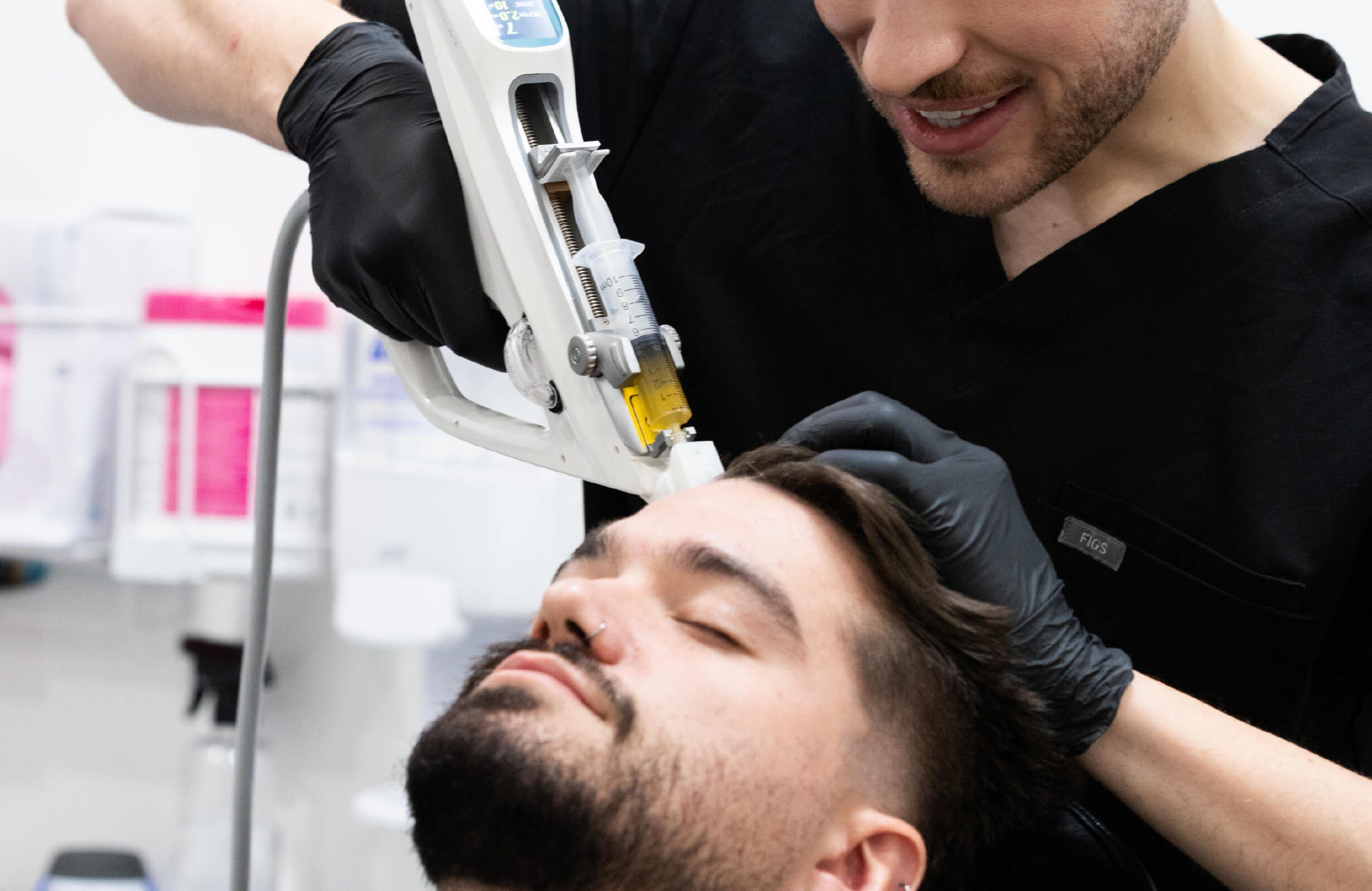 Traitement de repousse capillaire avec injection d’exosomes pratiqué sur un homme, visant à stimuler la croissance des cheveux et freiner la chute.