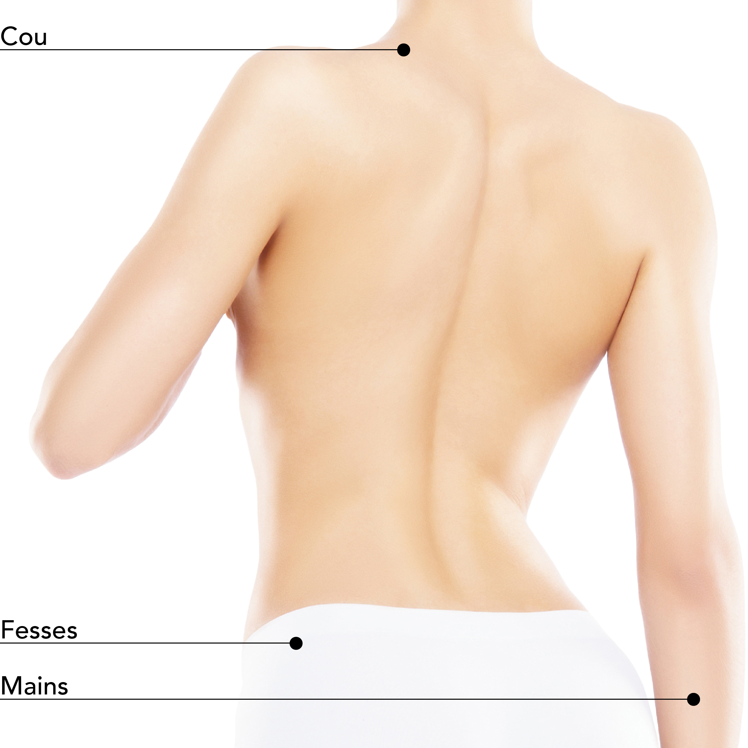 https://www.stlaurentme.com/wp-content/uploads/2025/08/Zones-Traitables_Dos_Femme_Sculptra.jpg