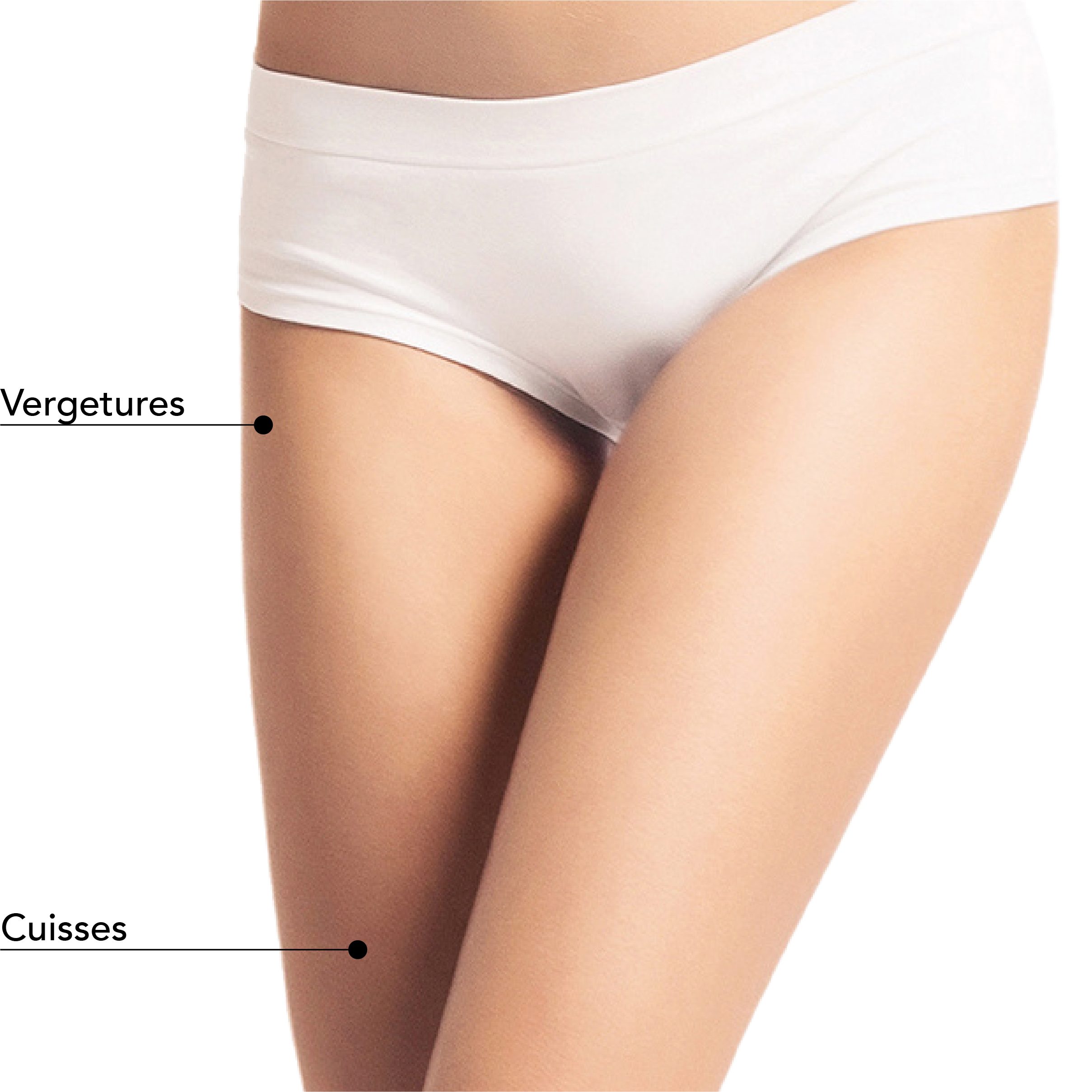 https://www.stlaurentme.com/wp-content/uploads/2025/08/Zones_Traitables_Jambes_Femme_Laser-CO2.jpg