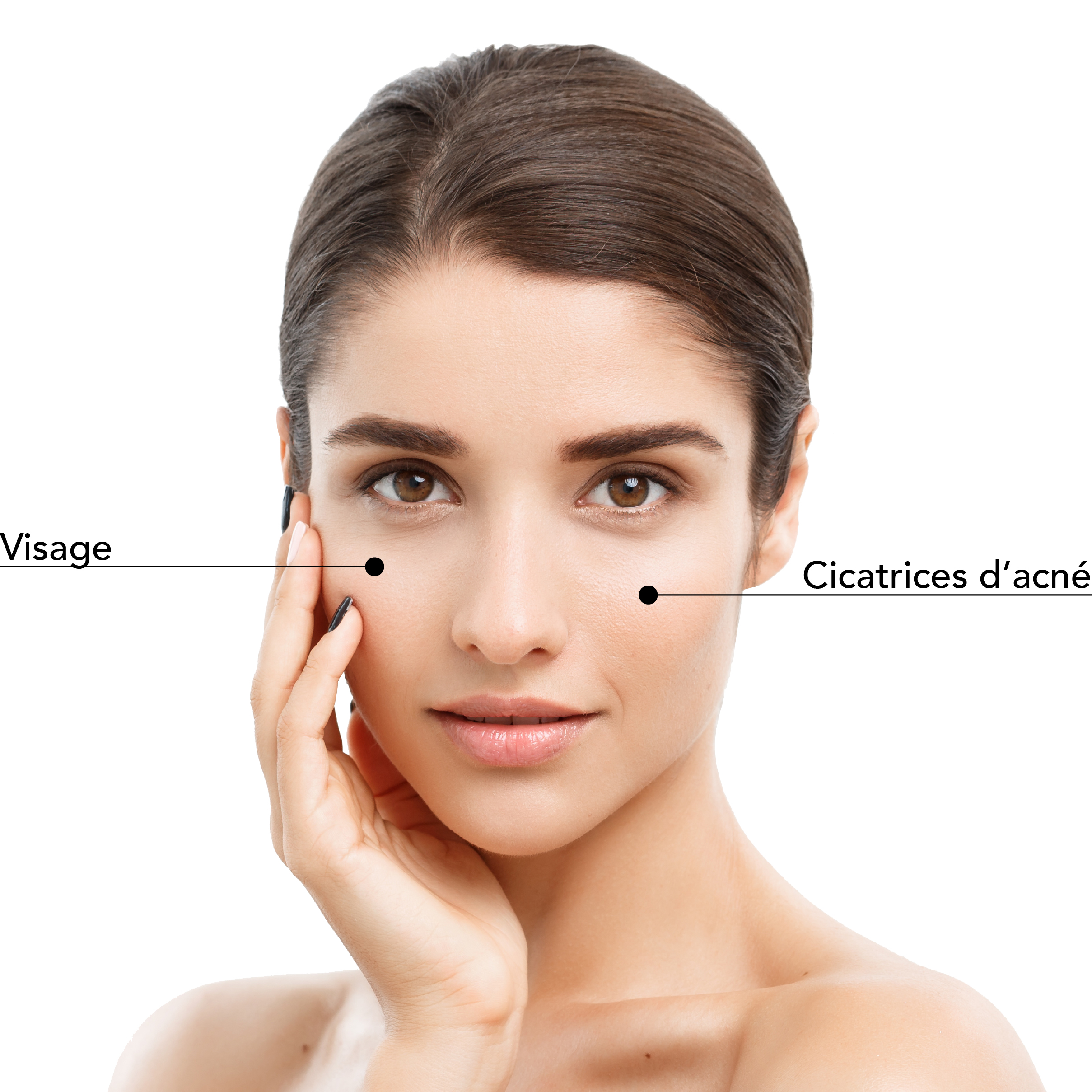 https://www.stlaurentme.com/wp-content/uploads/2025/08/Zones_Traitables_Visage_Femme_Subcision.jpg