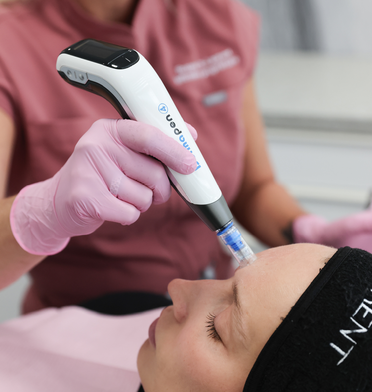 Traitement du visage aux exosomes réalisé avec un appareil de microneedling