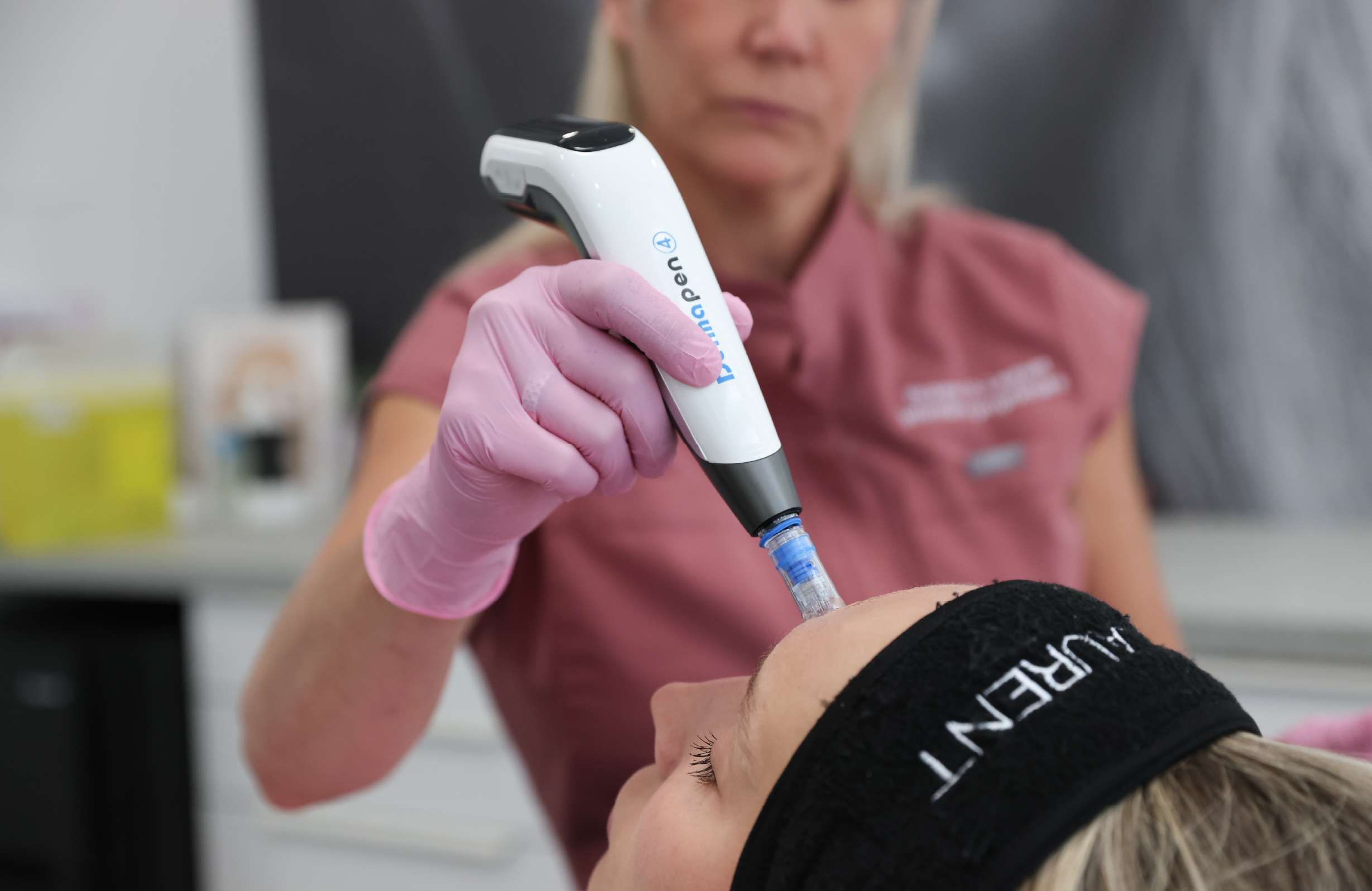 Professionnelle réalisant un traitement aux exosomes sur le front avec un appareil de microneedling