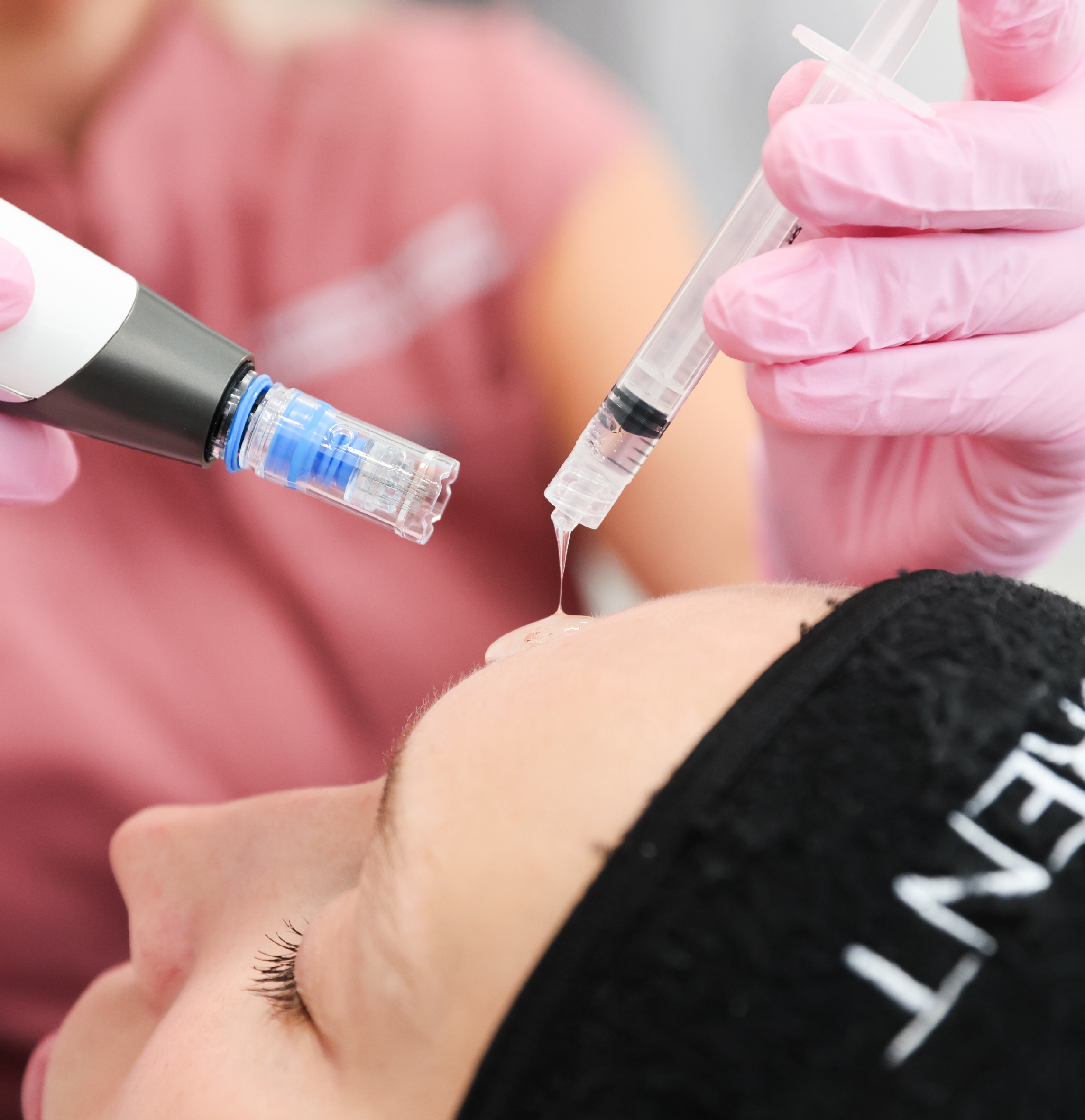 Application d’un sérum aux exosomes sur le visage à l’aide d’un appareil Dermapen