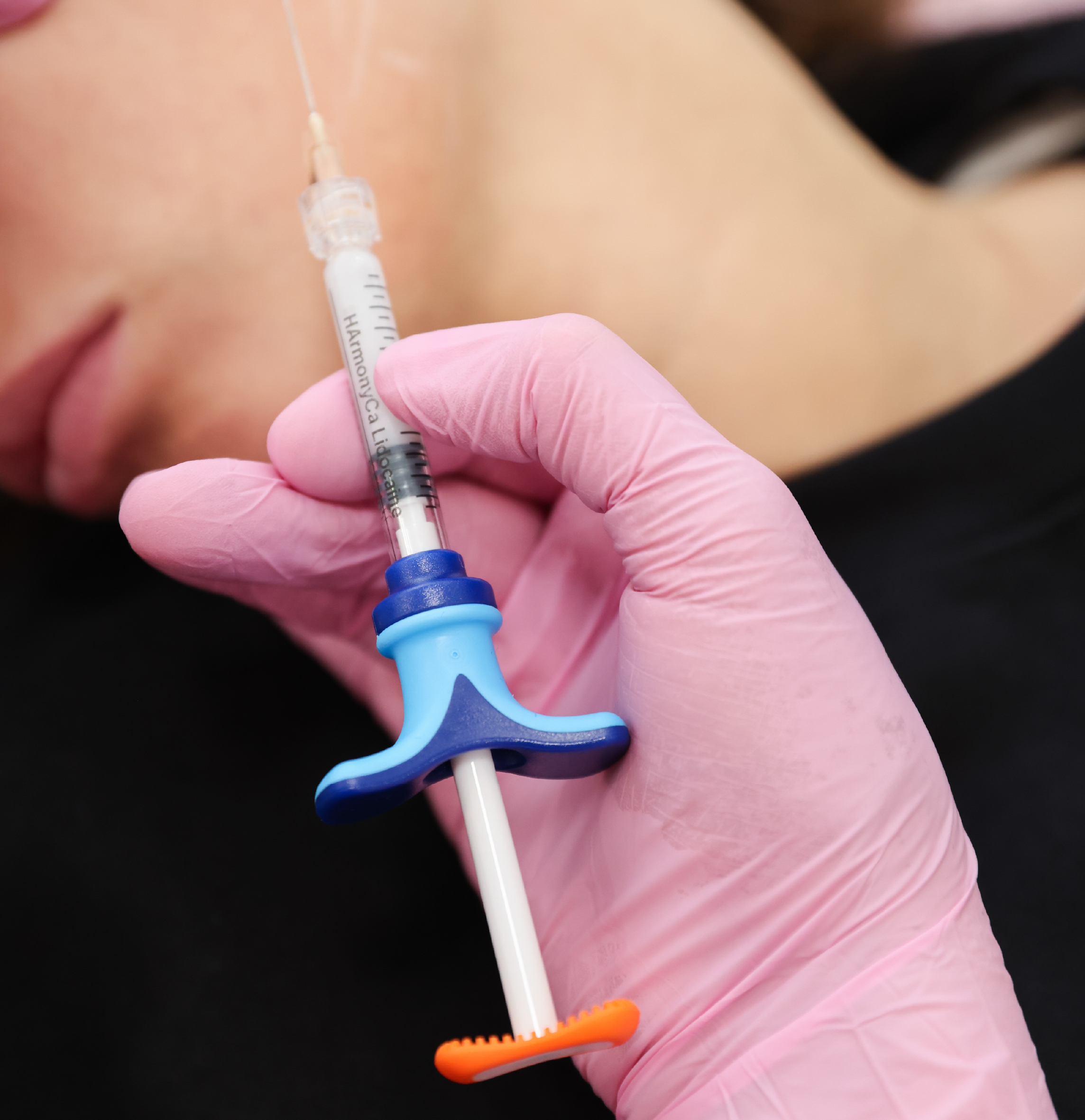 Gros plan sur une seringue HArmonyCa tenue par une professionnelle portant des gants roses, lors d’un traitement médico-esthétique du visage.