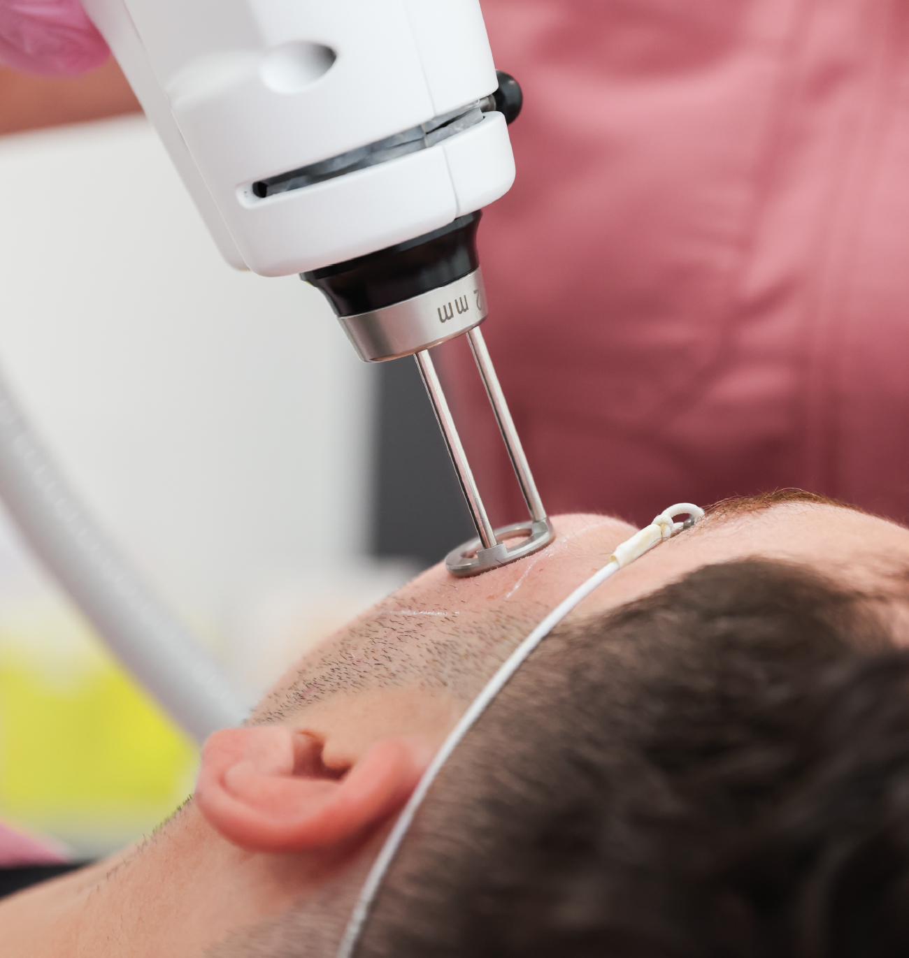 Traitement au laser Erbium appliqué sur la joue d’un patient