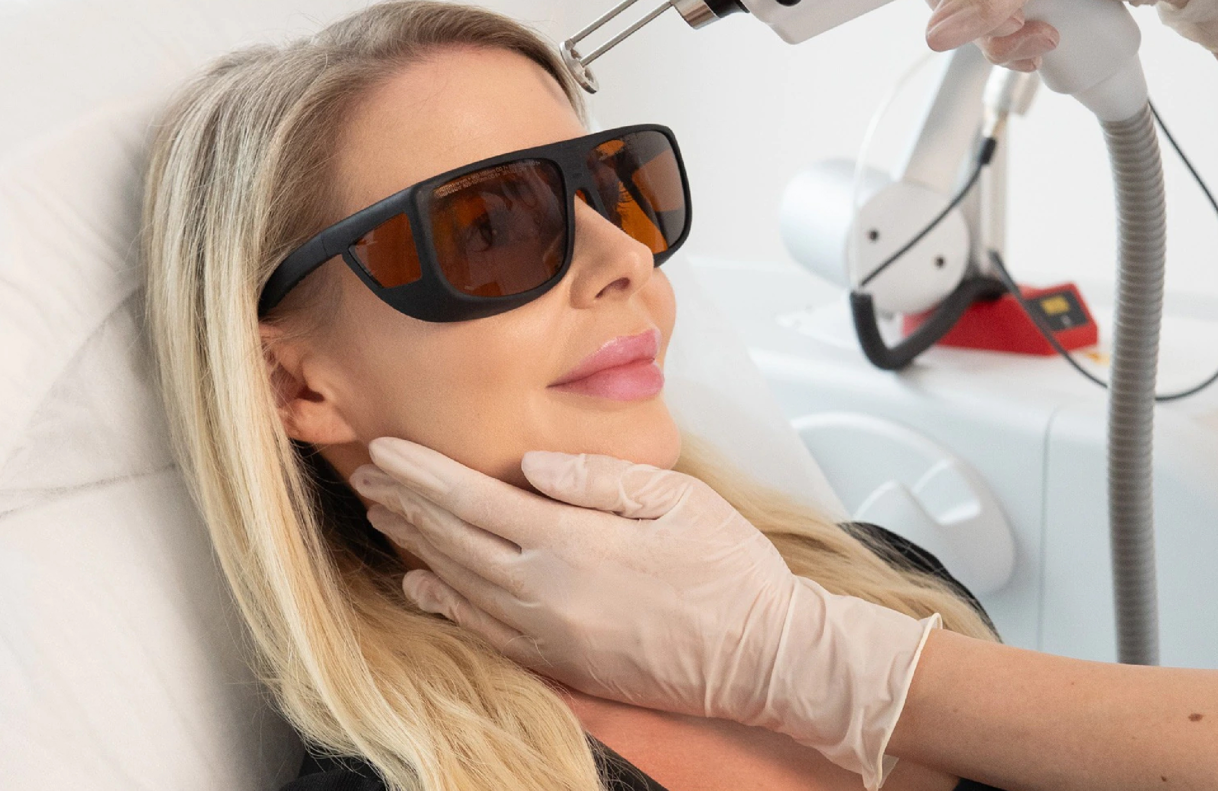 Patiente portant des lunettes de protection pendant une séance de laser Erbium du visage