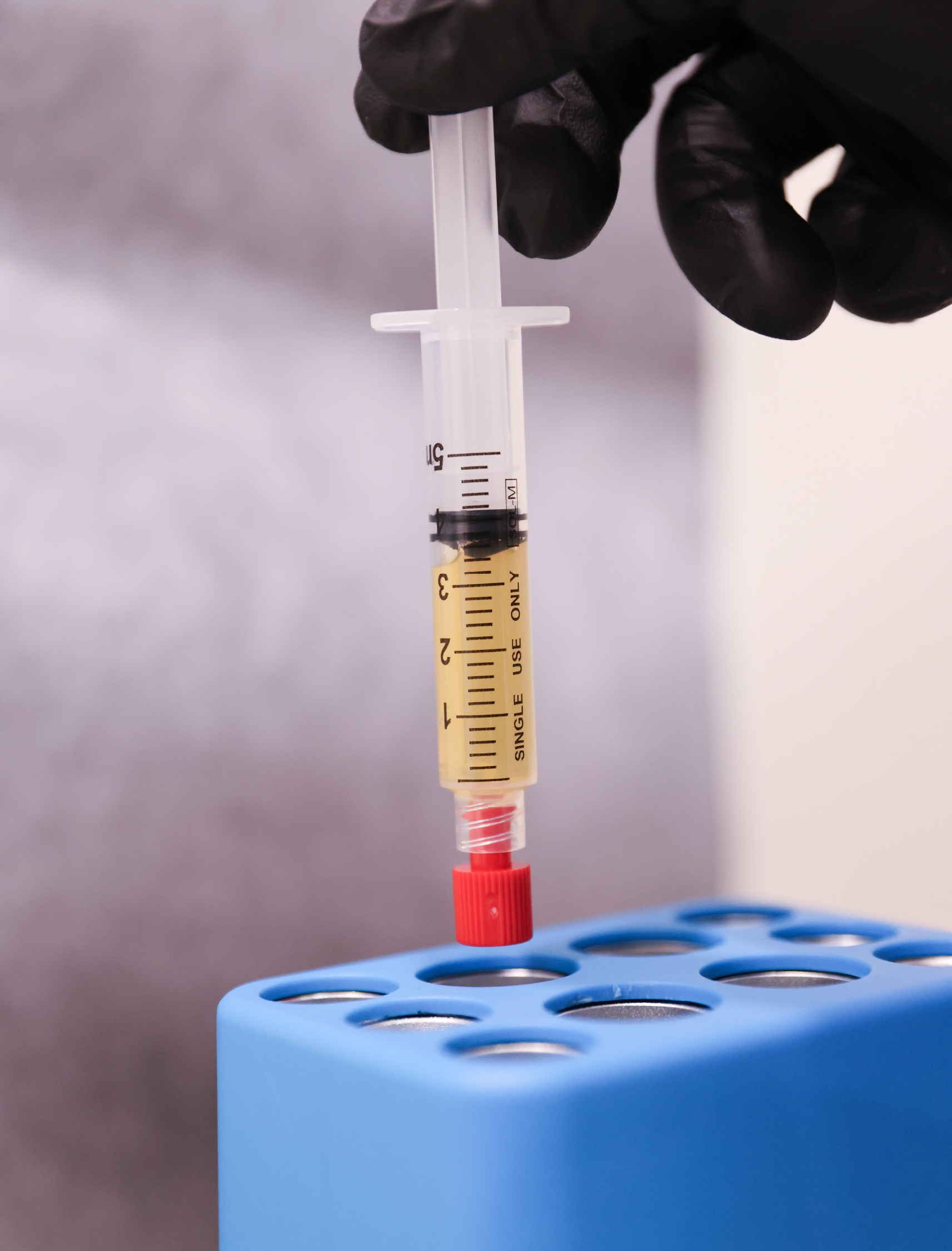 Gros plan sur une seringue contenant le PRF Gel, tenue par une main gantée au-dessus d’un support médical.