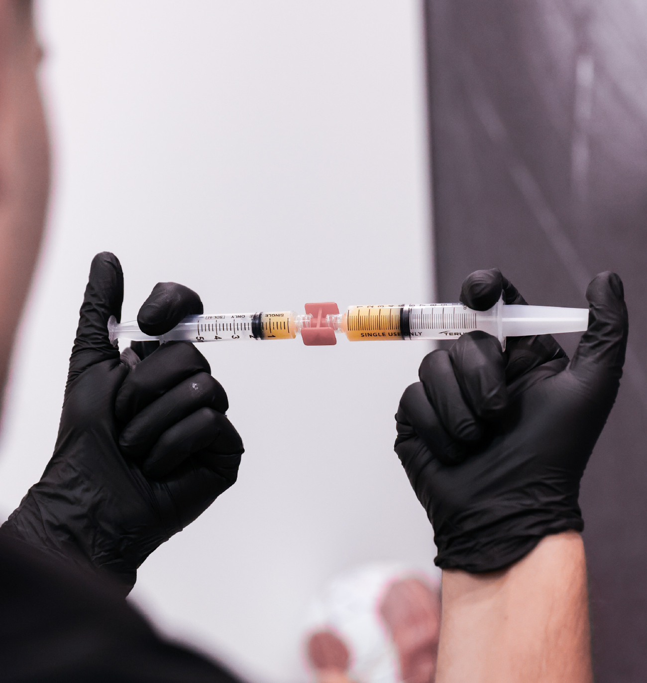 Séringues contenant du plasma riche en fibrine (PRF) manipulées par un professionnel de la santé portant des gants noirs.
