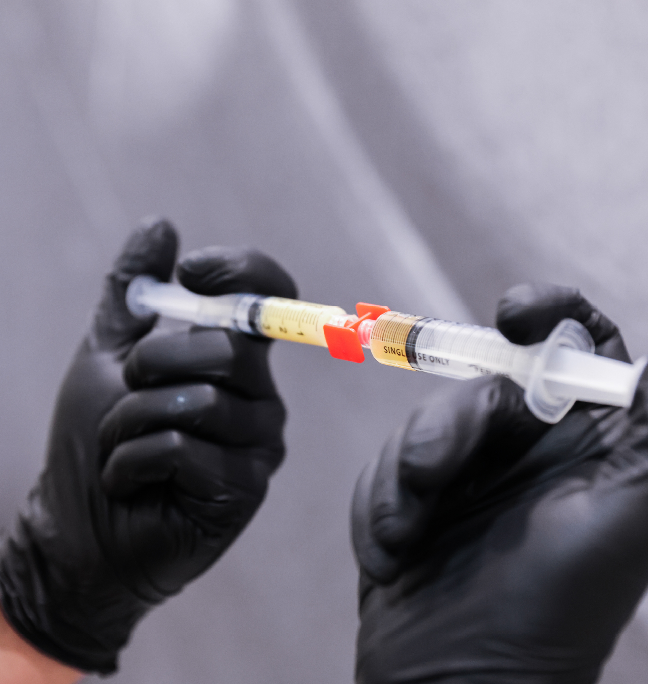Seringues contenant du PRP préparé pour un traitement médico-esthétique du visage.