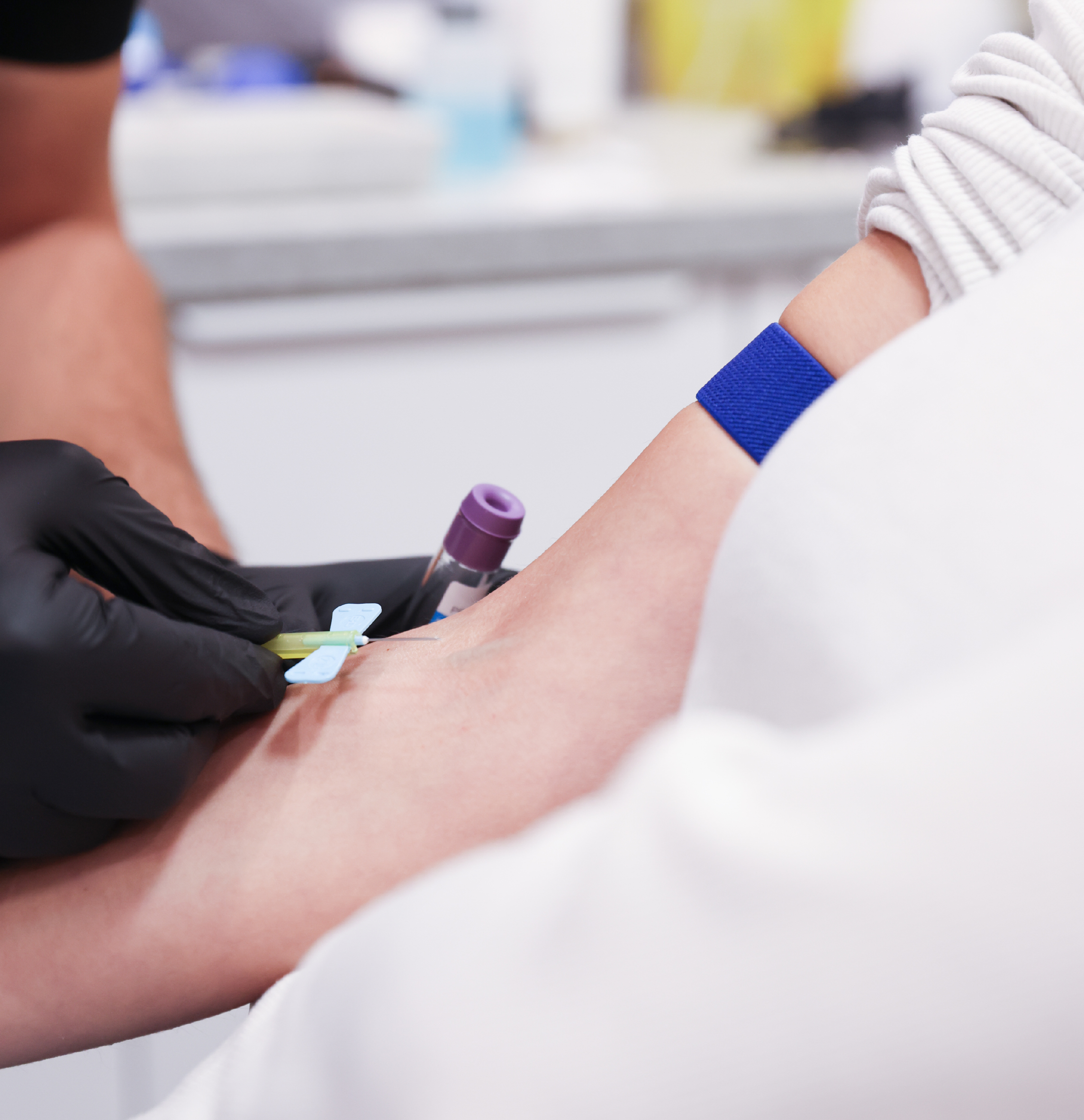 Prélèvement sanguin réalisé dans le cadre d’un traitement de PRP Gel, avec un tube de prélèvement tenu près du bras du patient.
